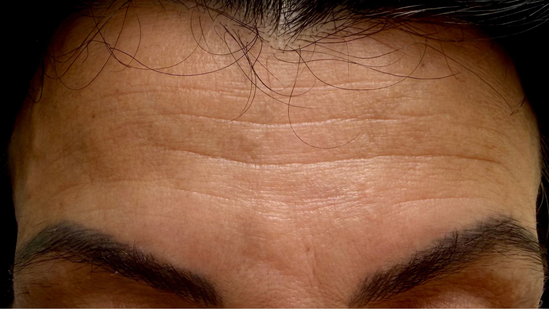 Close-up of a person's forehead and hairline with dark hair parted in the center.